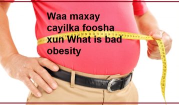 Waa maxay cayilka foosha xun What is bad obesity