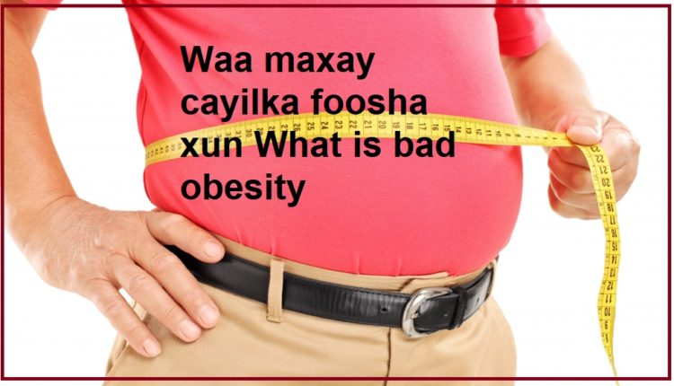 Waa maxay cayilka foosha xun What is bad obesity1