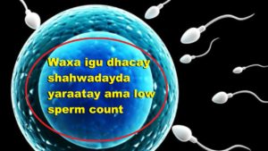 Waxa igu dhacay shahwadayda yaraatay ama low sperm count