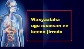 Waxyaalaha ugu caansan ee keeno jirrada 